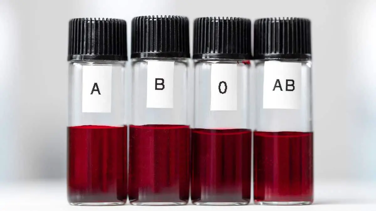 Tubes With Blood Types